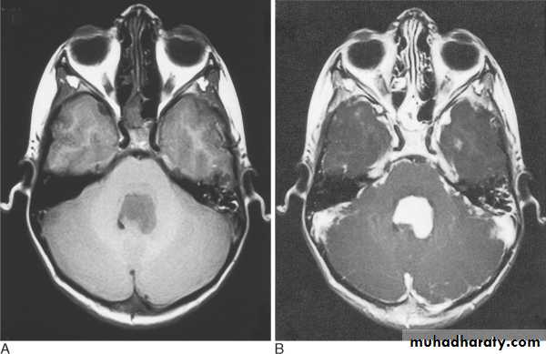 MRI physics