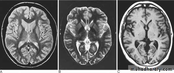 MRI physics