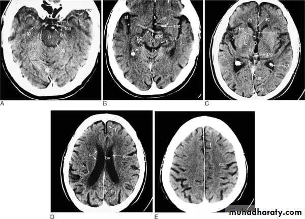 MRI physics