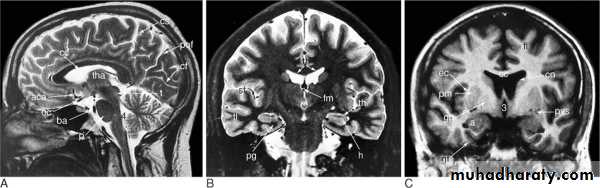 MRI physics