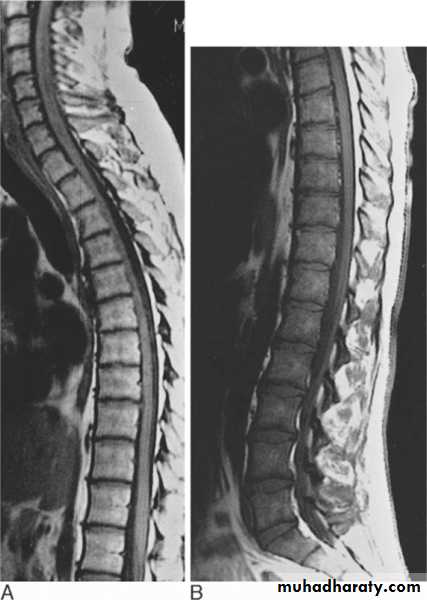 MRI physics