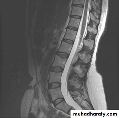 MRI physics