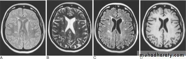 MRI physics