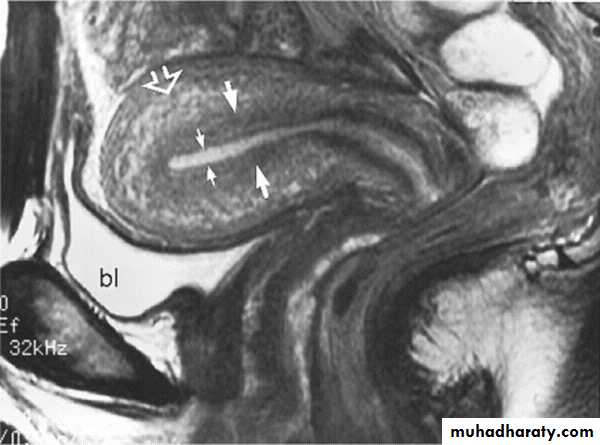 MRI physics