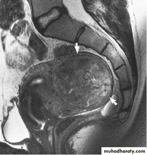 MRI physics