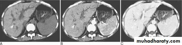 MRI physics