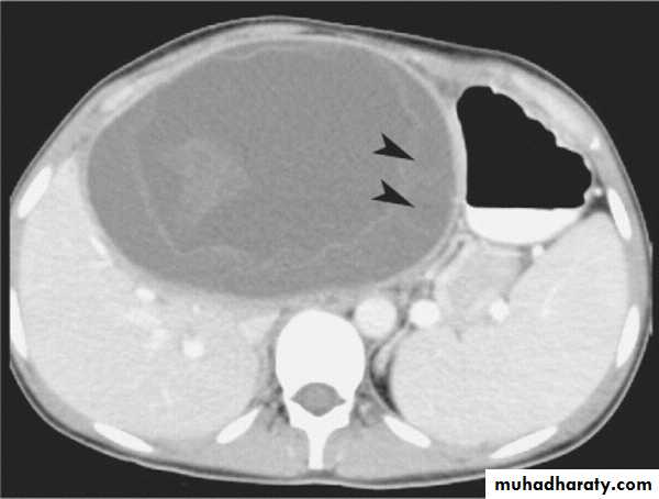 MRI physics