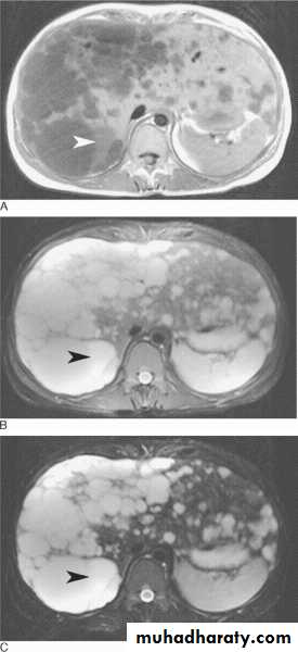 MRI physics