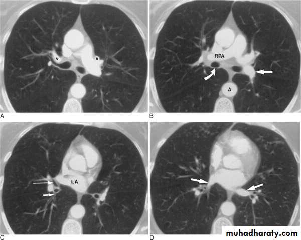 MRI physics