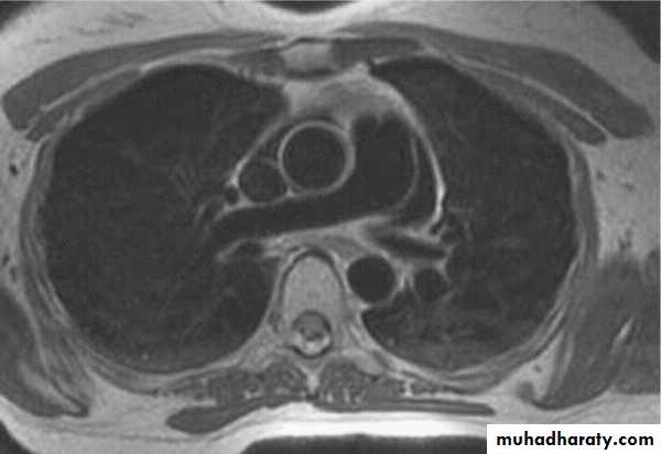 MRI physics