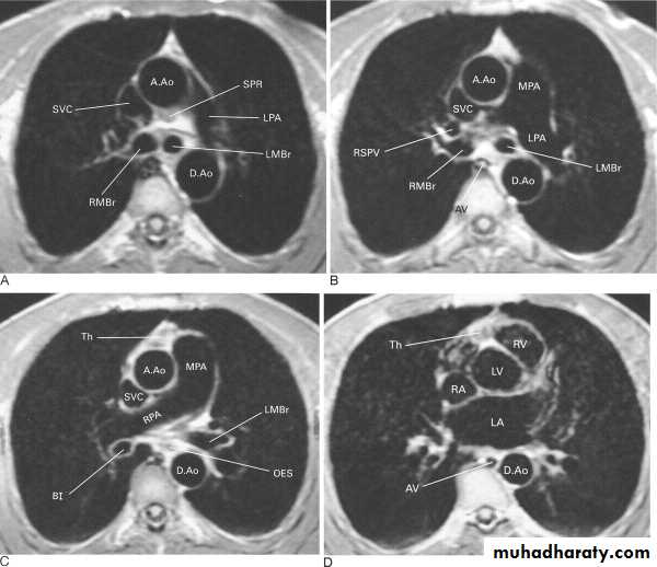 MRI physics