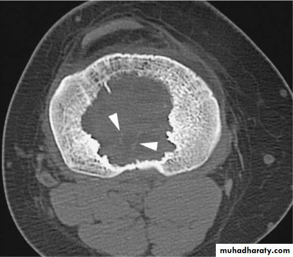 MRI physics