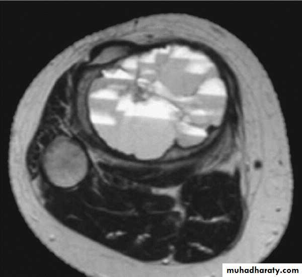 MRI physics