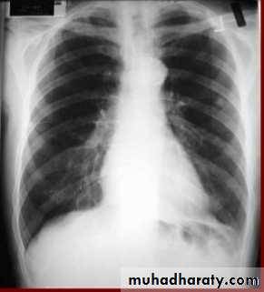 Chest C-ray