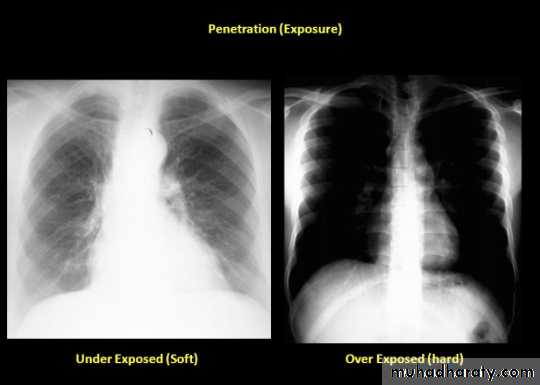 Chest C-ray