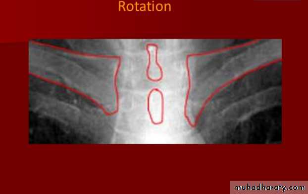 Chest C-ray