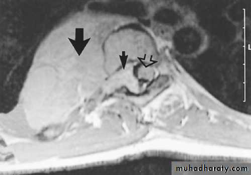 Chest C-ray
