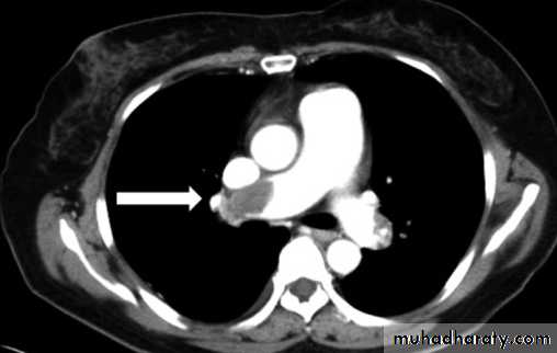 Chest C-ray