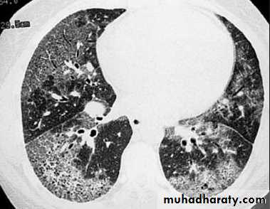 Chest C-ray