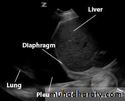 Chest C-ray