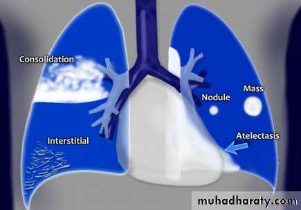 Chest C-ray