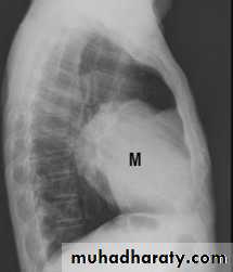 Chest C-ray