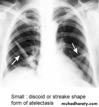Chest C-ray