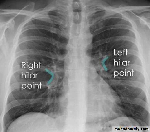 Chest C-ray