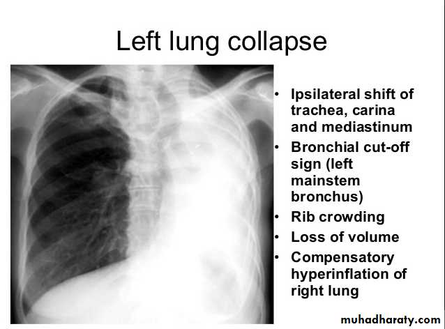 Chest C-ray
