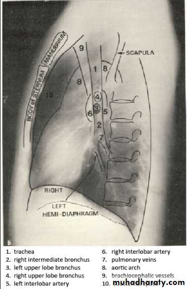 Chest C-ray
