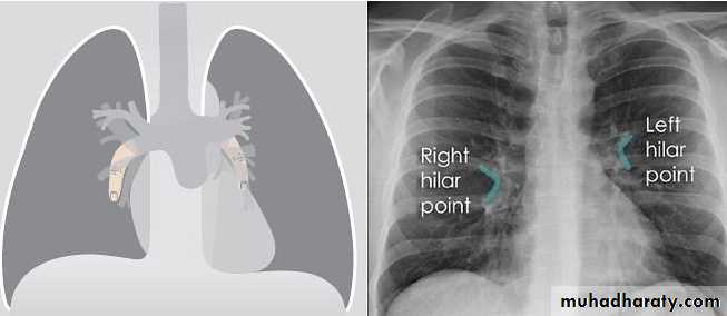 Mediastinum