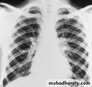 Mediastinum
