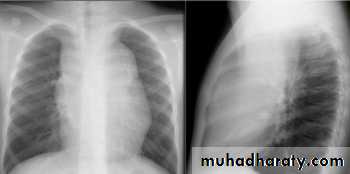 Mediastinum
