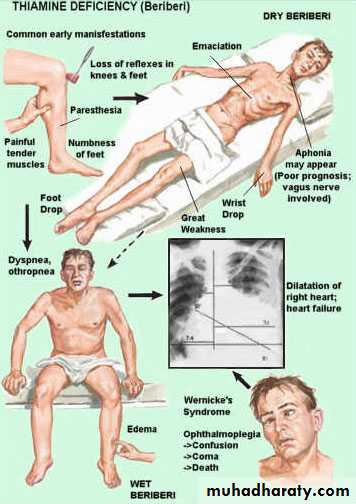 Malabsorption of Fat-Soluble Vitamins