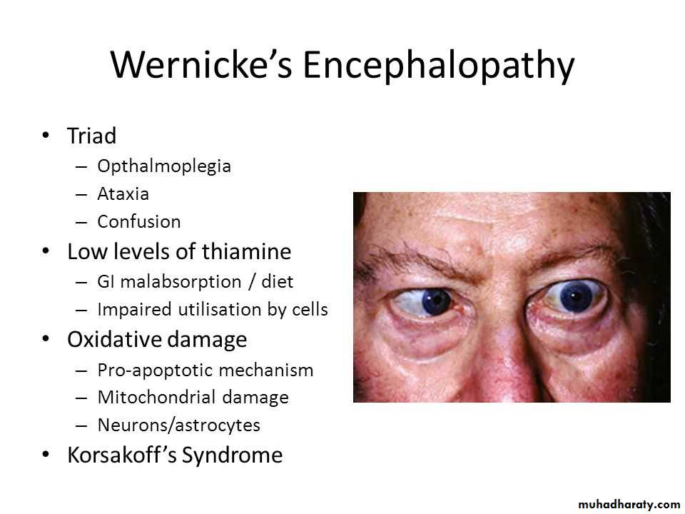 Malabsorption of Fat-Soluble Vitamins