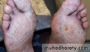 Malabsorption of Fat-Soluble Vitamins