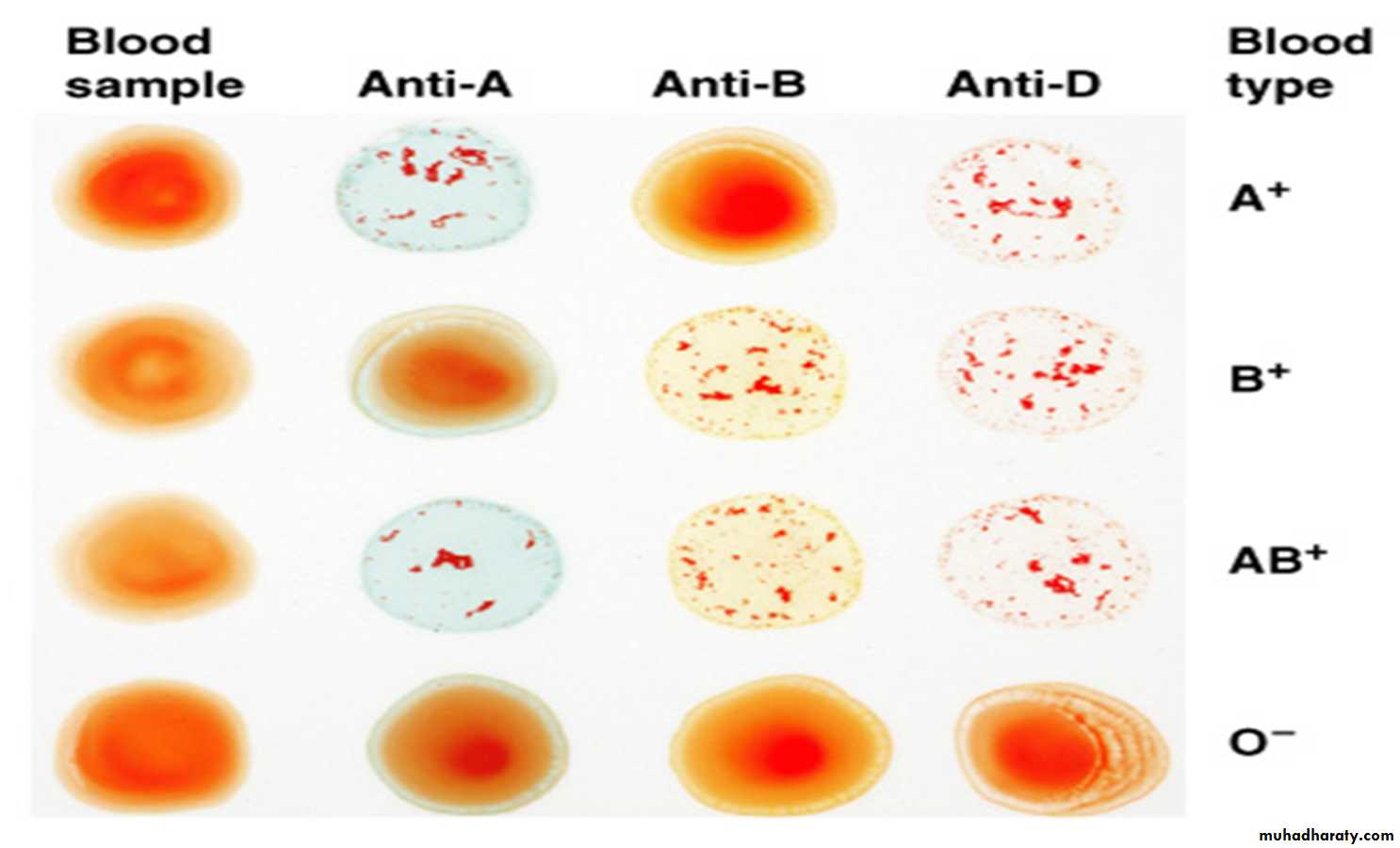 Blood Typing & Transfusion Physiology