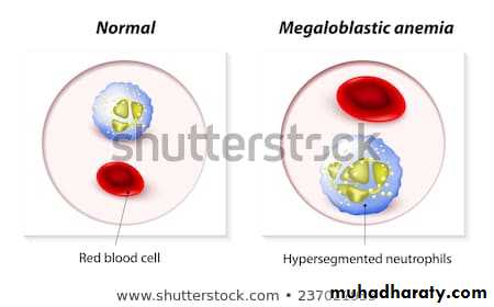 Nutritional Deficiency