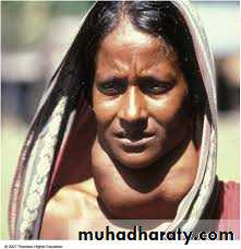 Nutritional Deficiency