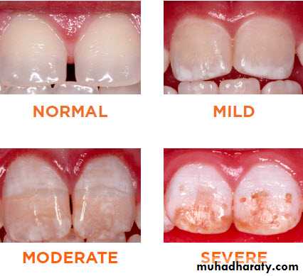 Nutritional Deficiency