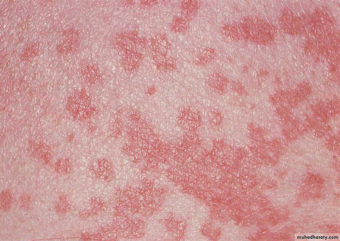 Overview of Viral Infections