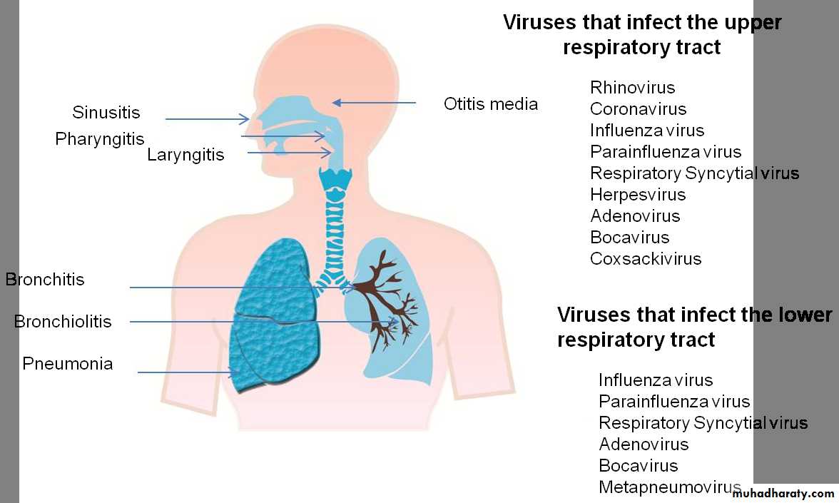 Overview of Viral Infections