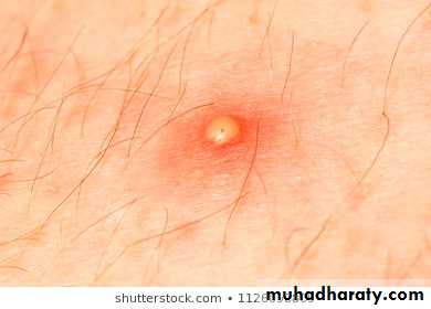 Overview of Viral Infections