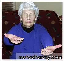 Hypertension and Stroke