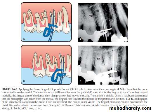 INTERPRETATION OF ENDODONTIC RADIOGRAPH