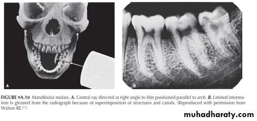 INTERPRETATION OF ENDODONTIC RADIOGRAPH