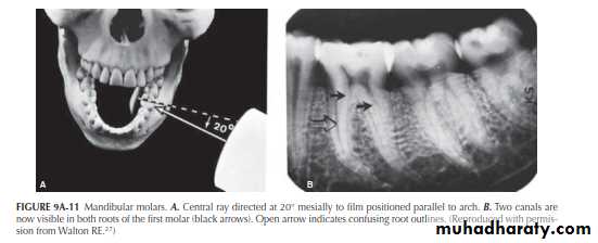 INTERPRETATION OF ENDODONTIC RADIOGRAPH