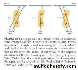 INTERPRETATION OF ENDODONTIC RADIOGRAPH