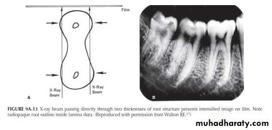 INTERPRETATION OF ENDODONTIC RADIOGRAPH