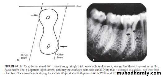 INTERPRETATION OF ENDODONTIC RADIOGRAPH